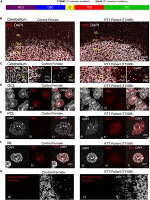 MECP2 Mutation Interrupts Nucleolin–mTOR–P70S6K Signaling in Rett Syndrome Patients